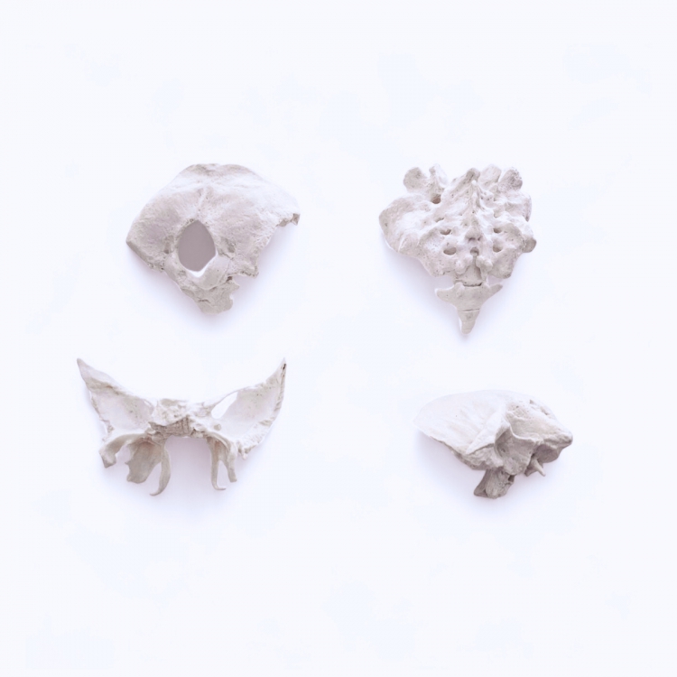 Bag of Bones: Occiput, Sacrum Temporal and Sphenoid Bones 枕骨、骶骨、顳骨和蝶骨