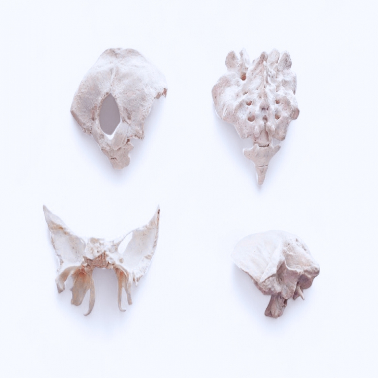Bag of Bones: Occiput, Sacrum Temporal and Sphenoid Bones 枕骨、骶骨、顳骨和蝶骨